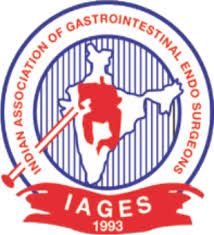 indian association of gastrointestinal endo surgeons