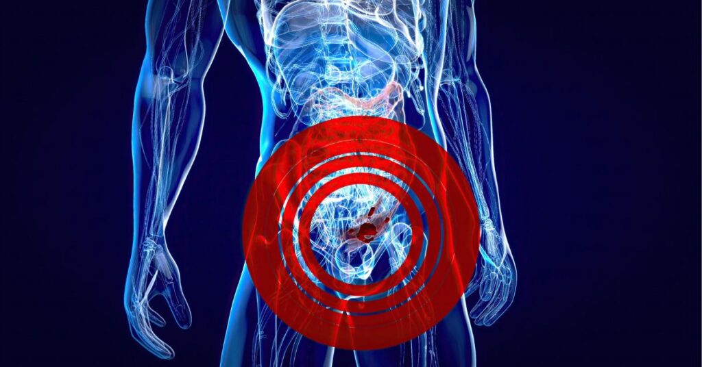 Expert fissure treatment in Indore – fast relief and personalized care for anal fissure patients