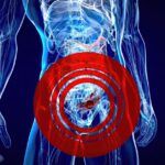 Expert fissure treatment in Indore – fast relief and personalized care for anal fissure patients