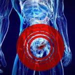 hernia doctor in indore