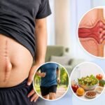 Incisional Hernia Treatment in Indore