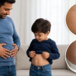 Umbilical Hernia
