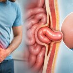 Hernia Signs and Symptoms