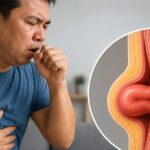 hernia care