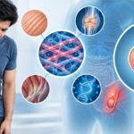 Connective Tissue Disorders and Hernia