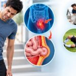 Traumatic Hernia
