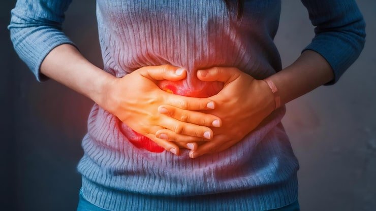 Woman with abdominal pain from a hernia