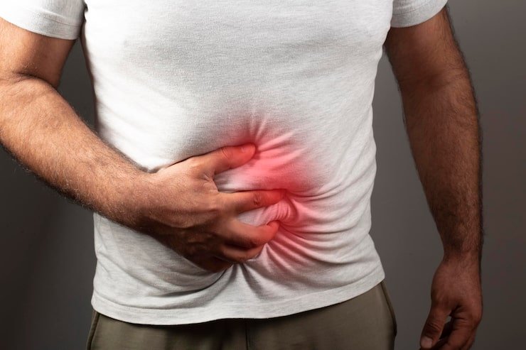Patient showing hernia pain area on the abdomen before hernia treatment in Indore
