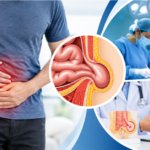Hernia Treatment
